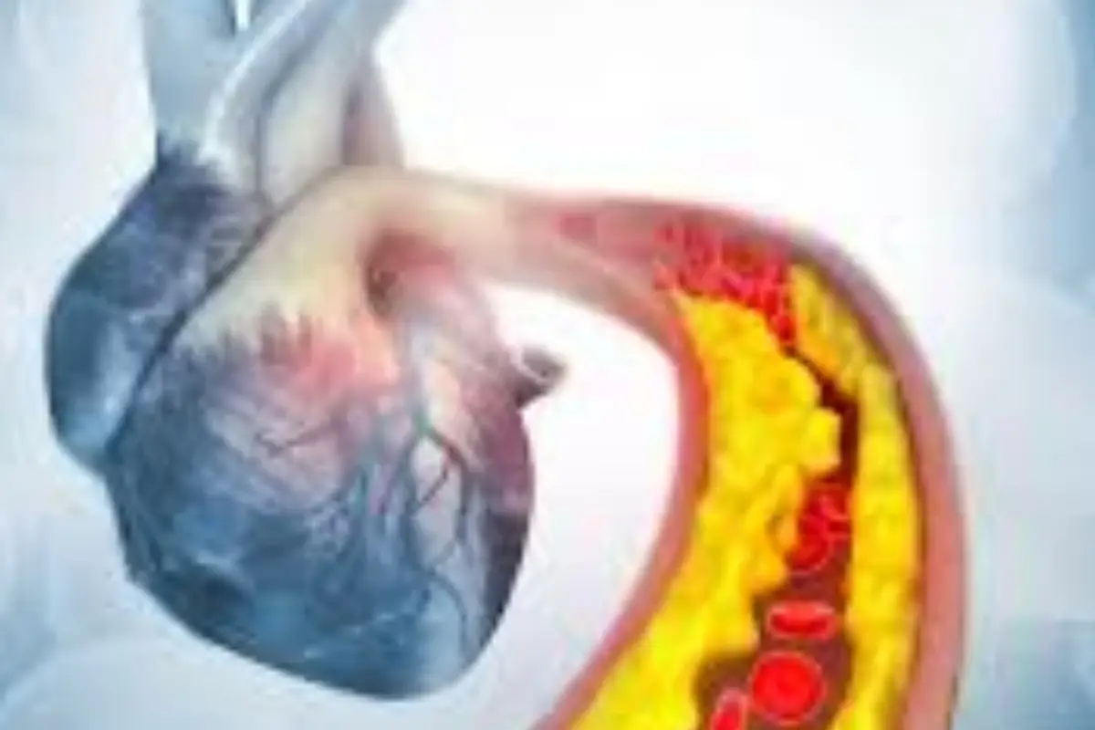 Malattie cardiovascolari: quante persone sono colpite in Italia e nel mondo e perché è importante conoscerne i numeri