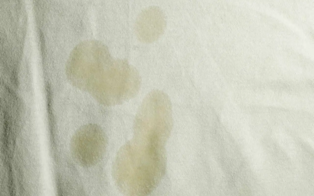 Come eliminare le macchie dopo il lavaggio a secco: i consigli degli esperti